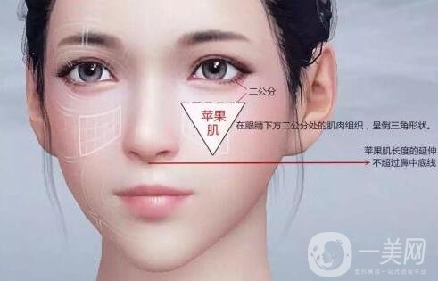 注射填充蘋(píng)果肌之后能笑嗎?會(huì)僵硬嗎?