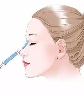 注射隆鼻整形需要多少錢?