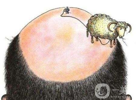 廣州頭發(fā)種植多少錢?收費(fèi)標(biāo)準(zhǔn)是什么?