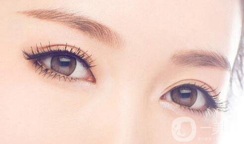 割雙眼皮過程大概需要多長時間?