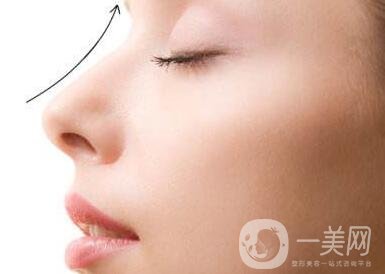 北京整容墊鼻梁多少錢？附隆鼻價格明細(xì)一覽表