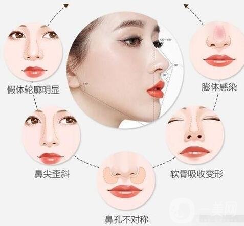 隆鼻修復(fù)手術(shù)價(jià)格多少錢?什么原因會(huì)影響價(jià)格?