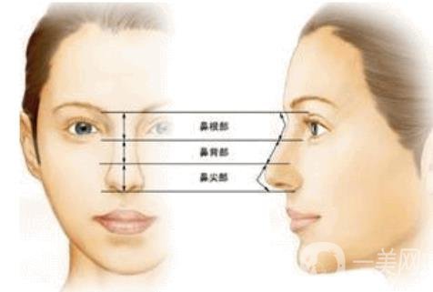 北京朝天鼻整容多少錢?具體怎么改良？