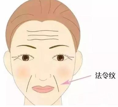 法令紋怎么祛除又*又*