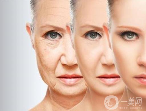 下筋膜懸吊祛皺術怎么操作的？*果嗎？