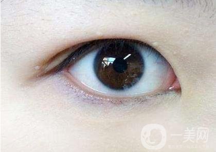 內(nèi)雙怎么變外雙？能貼雙眼皮貼嗎？