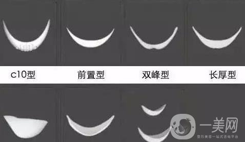 膨體隆下巴多久會變軟？容易取出來嗎？