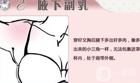 腋下副乳手術的價格是多少?影響因素有哪些呢?