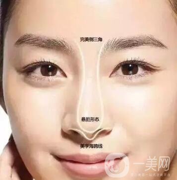 隆鼻手術(shù)怎么做？操作過(guò)程解析