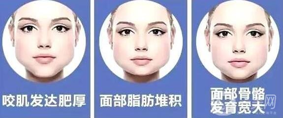 咬肌切除手術多少錢?有哪些影響因素?