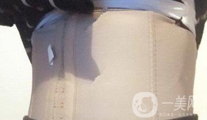 360度環(huán)形吸脂