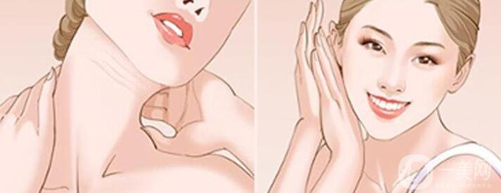 如何消除頸紋讓頸部變得緊實(shí)?