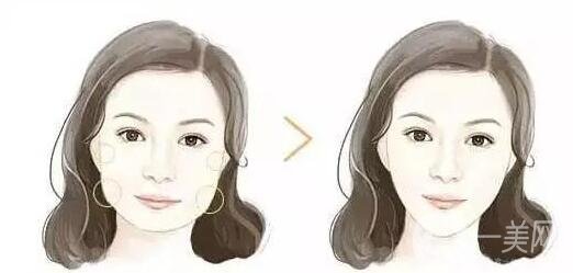 *打幾次能定型?*果怎么樣