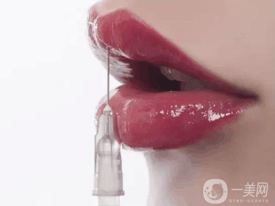 玻尿酸豐唇珠*果怎么樣?前期會(huì)腫嗎?