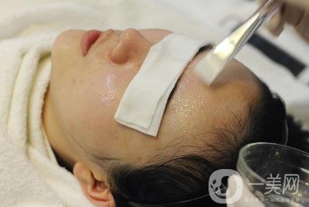 光子嫩膚價(jià)格多少？貴嗎？