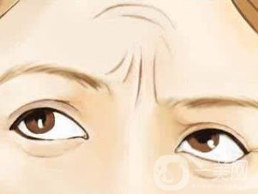 抬頭紋怎么去除？價格是多少呢？