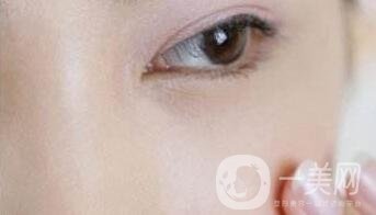 玻尿酸豐淚溝有危險嗎？能管多久？