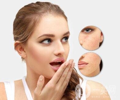 激光嫩膚價(jià)格一般是多少？*果好不好？