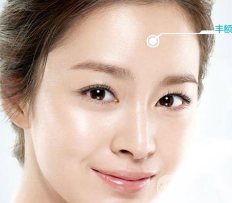 隆額頭材料哪種比較好？要多少錢？