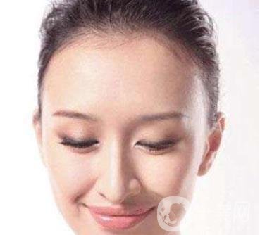 隆額頭材料哪種比較好？要多少錢？