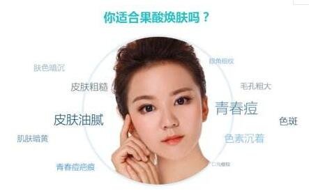 果酸換膚