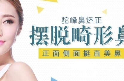 駝峰鼻矯正價(jià)錢(qián)貴嗎?大概是多少?