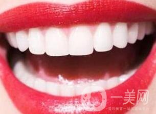鑲牙的種類各有什么優(yōu)缺點(diǎn)