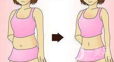 腹壁整形多少錢？費(fèi)用詳細(xì)解說