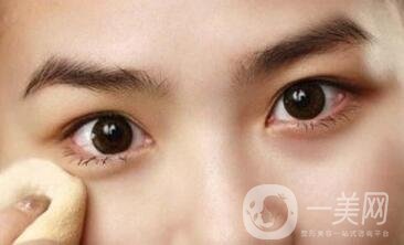 開(kāi)眼角好嗎？*果怎么樣？
