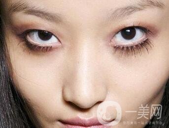 開(kāi)眼角好嗎？*果怎么樣？