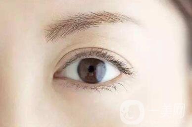 開(kāi)眼角好嗎？*果怎么樣？