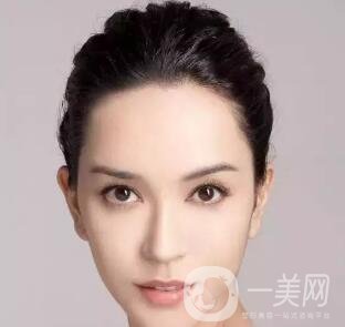 隆鼻手術(shù)的風(fēng)險(xiǎn)大嗎？有哪些？