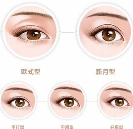吸雕雙眼皮手術(shù)過(guò)程介紹和注意事項(xiàng)一覽