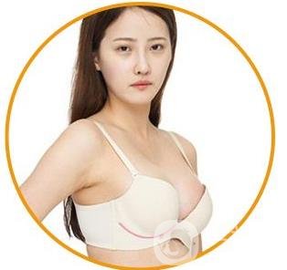 娜綺麗假體隆胸后多久可以變軟？