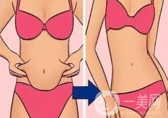 360度吸脂減肥是指環(huán)吸還是水動力？