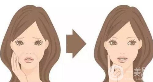 玻尿酸豐臉頰價(jià)格多少錢?怎樣計(jì)算?