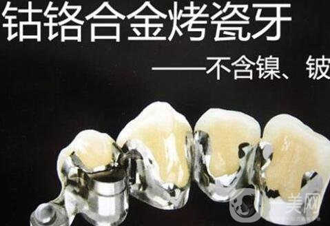 烤瓷牙價格和種類詳解公布