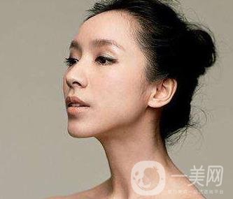 骨粉隆鼻后遺癥是什么樣的？