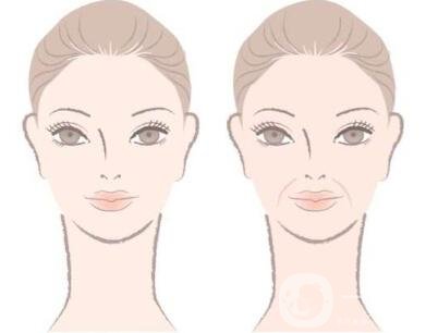 注射豐鼻唇溝*果*嗎？能立馬*果嗎？