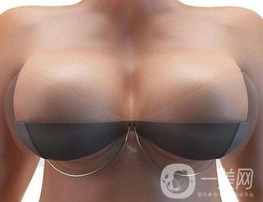 自身脂肪移植隆胸術(shù)有沒有副作用？