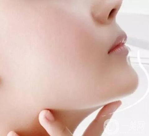 伊維蘭豐下巴大概多少錢啊?價格都一樣嗎