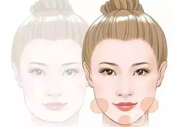 伊維蘭豐下巴大概多少錢啊?價格都一樣嗎