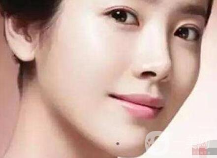 伊維蘭豐下巴大概多少錢啊?價格都一樣嗎