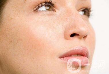 祛斑手術(shù)價(jià)格貴不貴？要多少錢(qián)？