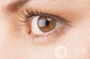 去除魚尾紋的方法有哪些？哪種方法比較好？