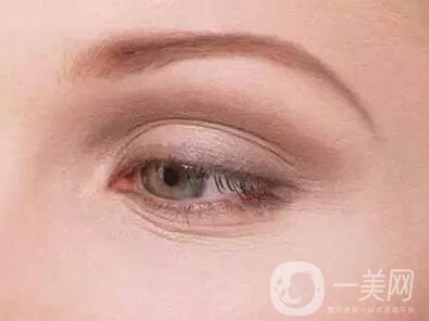 去除魚尾紋的方法有哪些？哪種方法比較好？