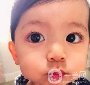 去頰脂墊價格貴嗎？大概價位是多少？