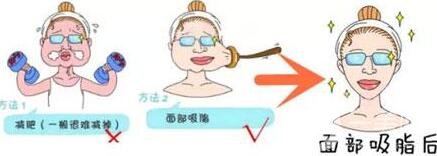 抽脂瘦臉手術過程*嗎?術后*果*嗎?