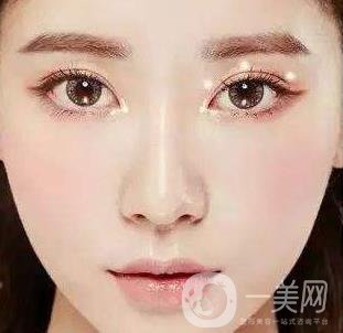 *需要拆線嗎？多長時間可以碰水？