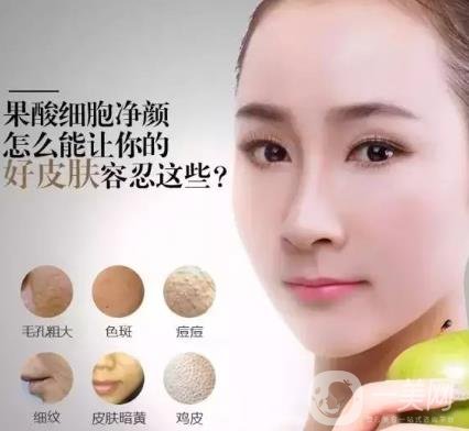 果酸換膚的作用是什么？功*是什么？